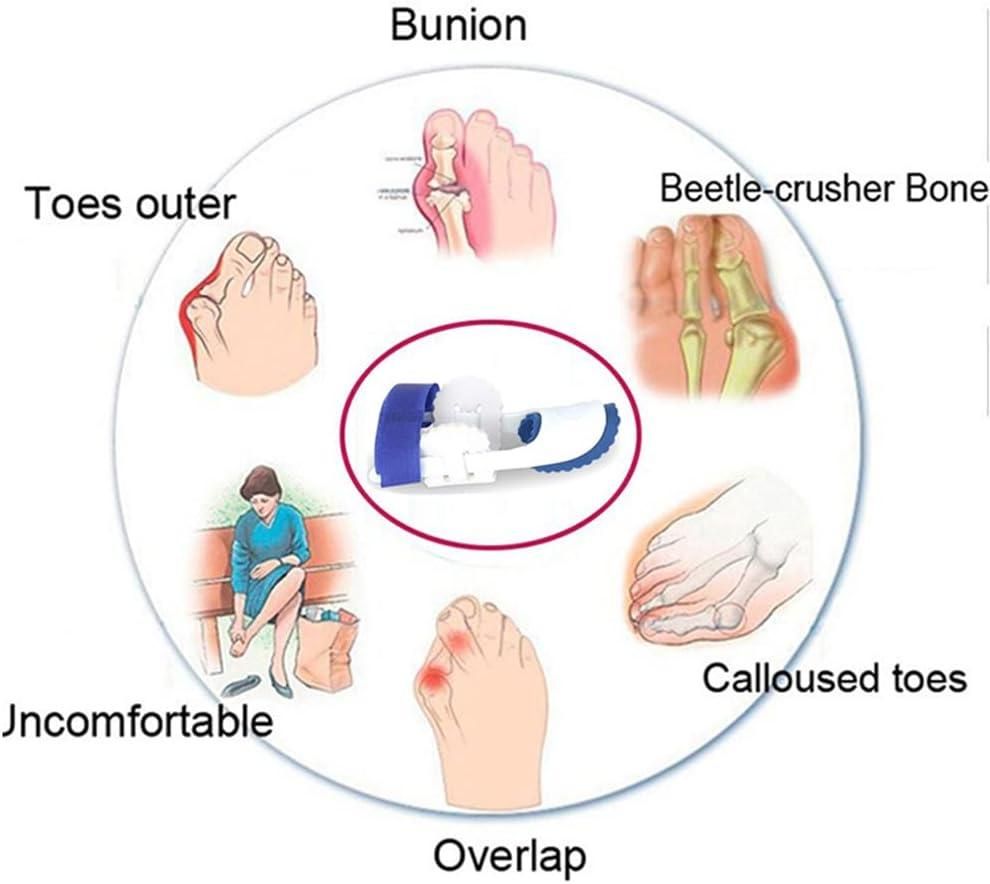 Foot Orthotic Bunion Splint Crooked Thumb Corrector (1 Pair)